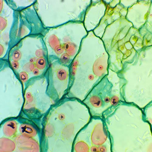 Trinocular Compound LED Microscope with 5MP Digital Camera V836