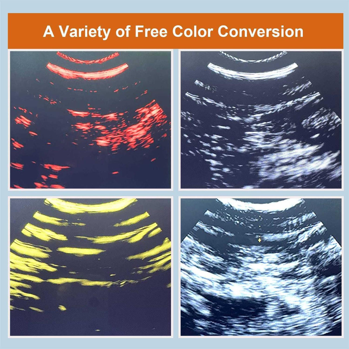Wireless Veterinary Ultrasound Scanner I292